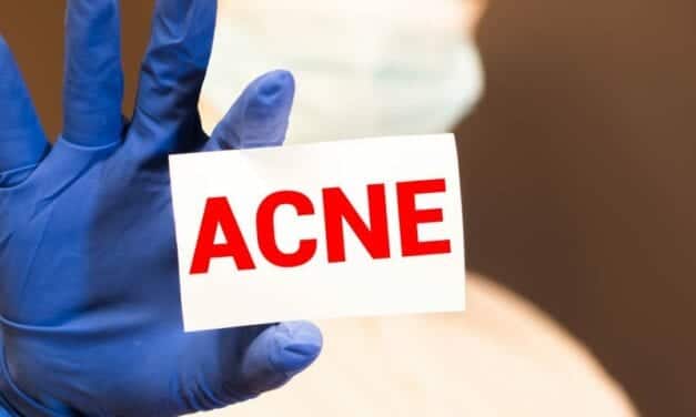 This Popular Acne Medication Carries a Disturbing Legacy