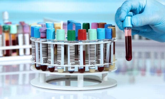 This Common Protein Could Be the Secret To a Much Longer, Healthier Life