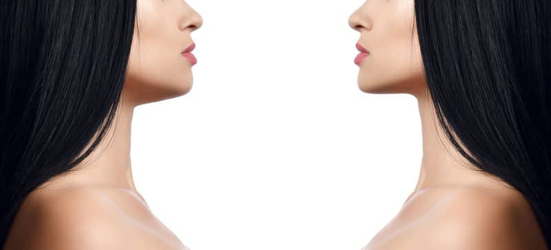 Influencing the Industry: Chin Liposuction Becoming Trend Among Young People
