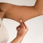 Sofwave Receives FDA Clearance for Treating Upper Arm Skin Laxity