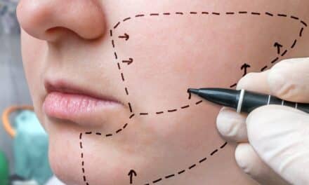 Plastic Surgery Leads to Happier Endings for Film Characters