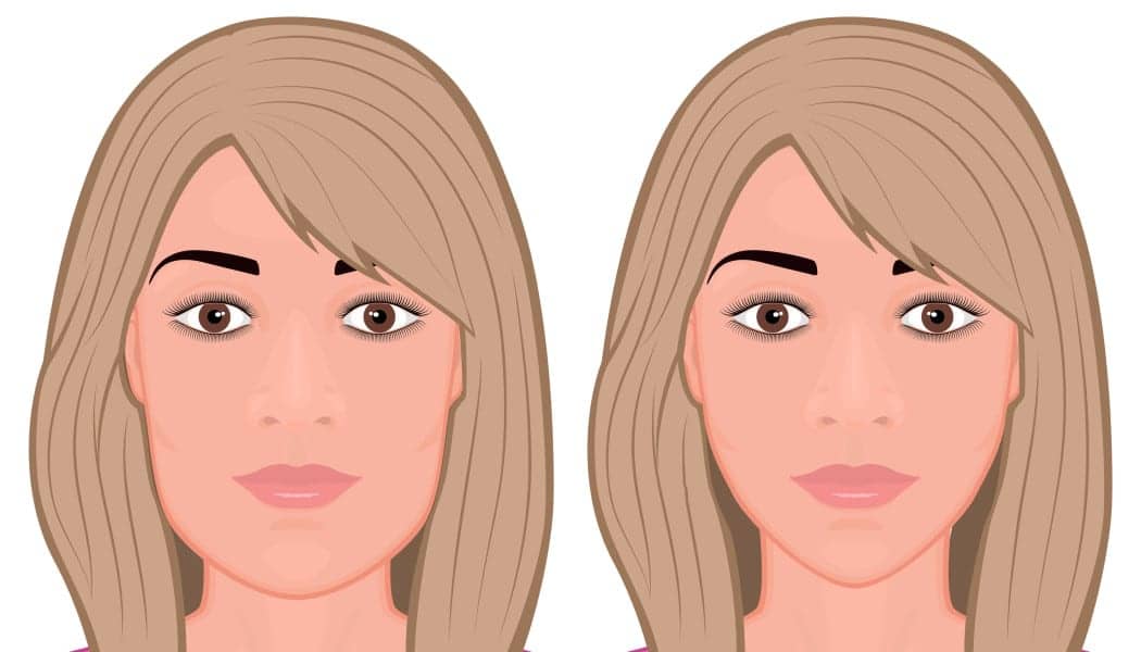 Rise Of The Golden Jawline – How Jawline Filler Became The Must-Have Aesthetic Treatment