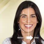 New AI Tools Help Med Spa Patients Visualize the End Results