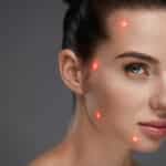 The Synergy of Light and Lotion: How Skincare is Transforming Laser Aesthetics