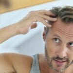 Evolution of Hair Restoration: From Stigma to Natural Results